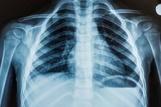 X-Ray at Samridhi Hospital